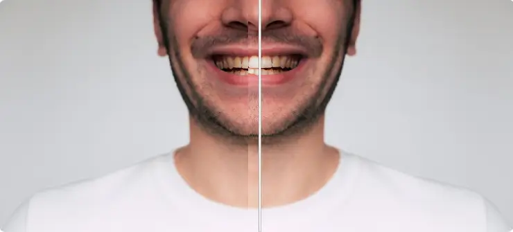 After Image